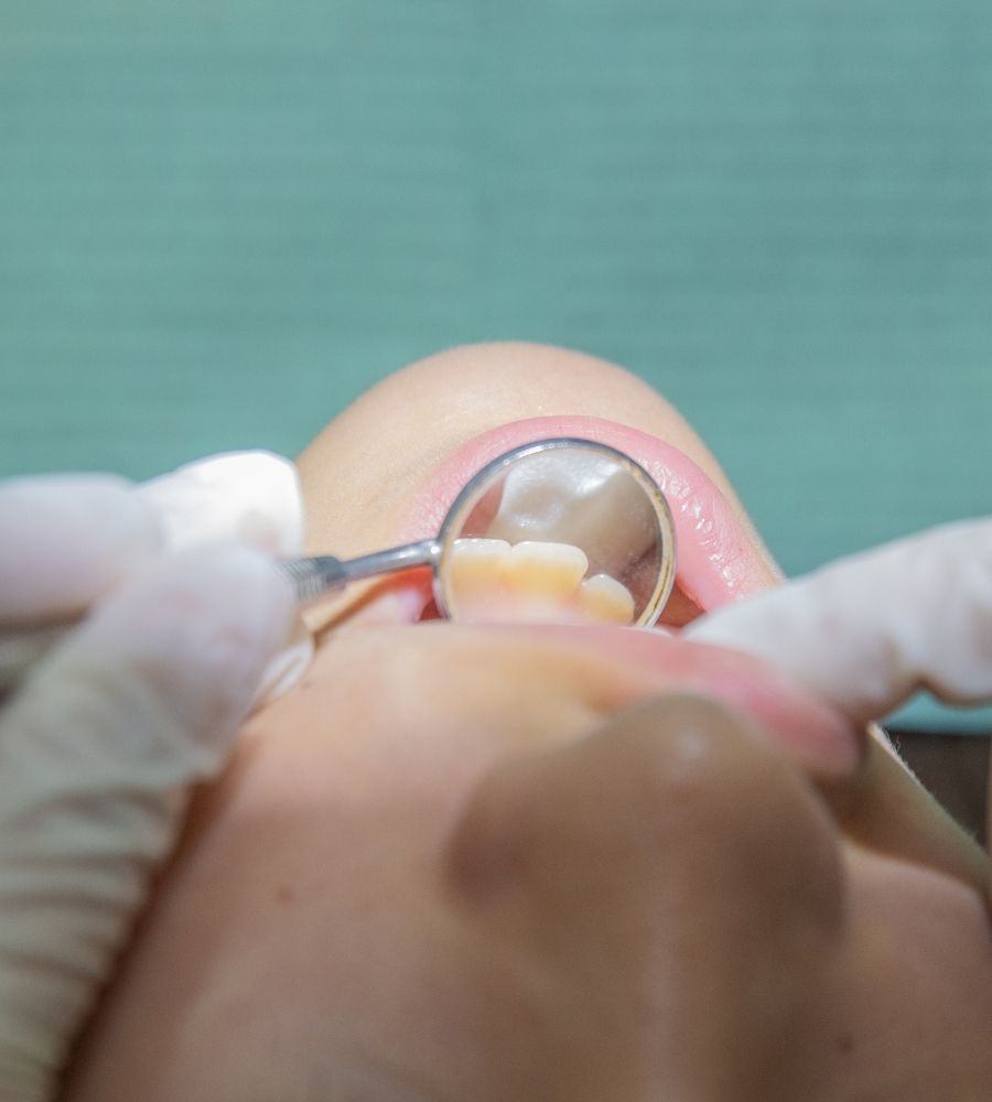 Clínica de empastes dentales en Barcelona
